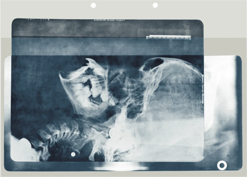 Röngtensichthüllen  Packung  100 Hüllen 211 x 297 mm, für 1 Aufnahme und DIN A4