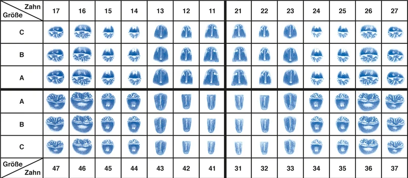 Glieder für vestibuläre Verblendungen GVV  Nachfüllpackung  25 Stück 22 C