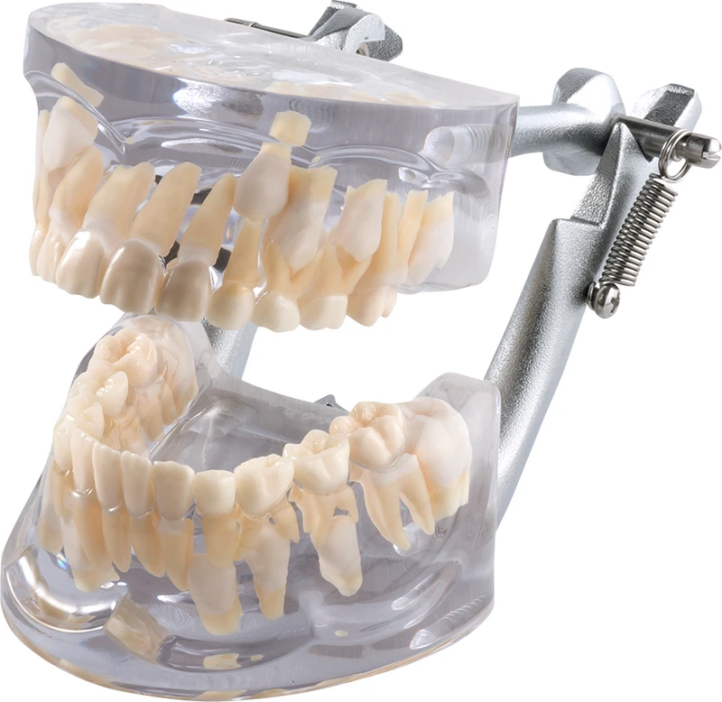 Wachstumsmodell transparent OK + UK P12D-100A  Stück