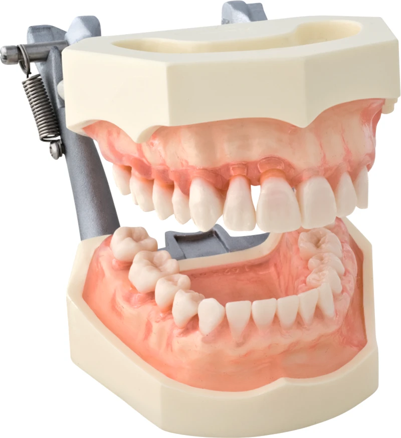 Parodontiemodell mit weichem, transparenten Zahnfleisch P15D-162H1  Stück