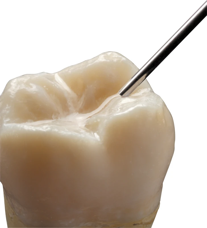 smartseal® & loc \ F  Standardpackung  2 x 1,5 g Spritze ohne Fluorid, transparent, 12 Nadeln schwarz