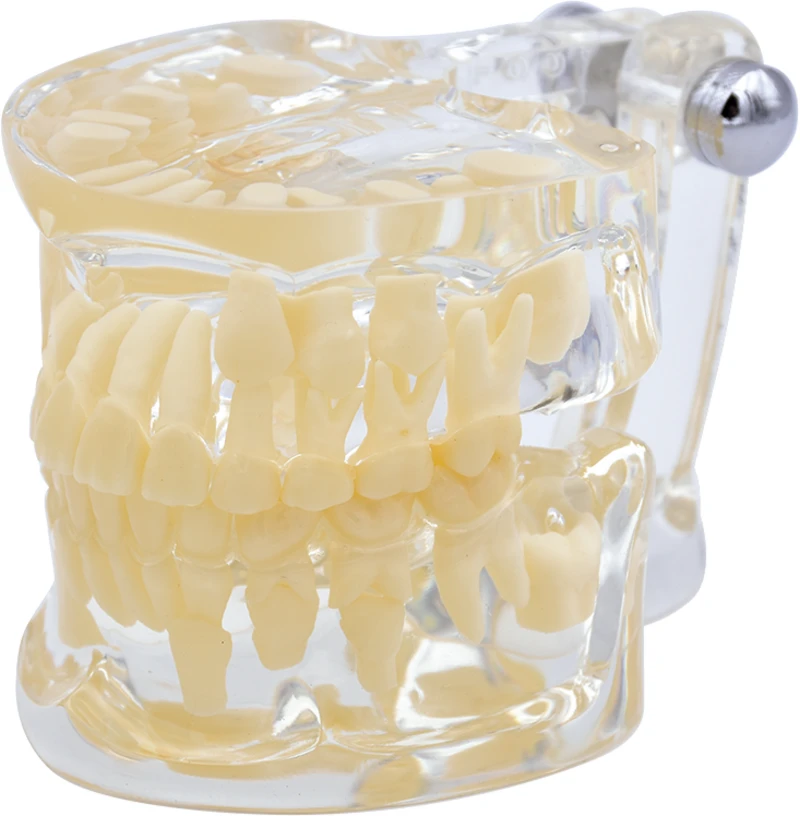 Studienmodell Transparent Kind De Luxe  Stück  UK und OK mit zehn Milchzähnen, transparent