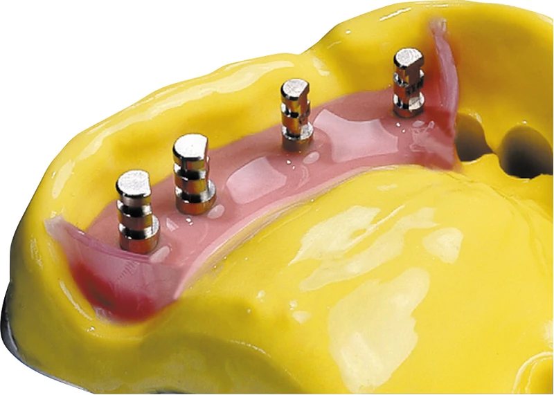 monoprint supra  Packung  2 x 50 ml Doppelkartusche, 6 Mischkanülen