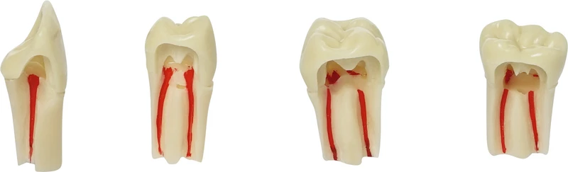 Modellzähne AG-3 ZPUR  Stück  Nr. 26