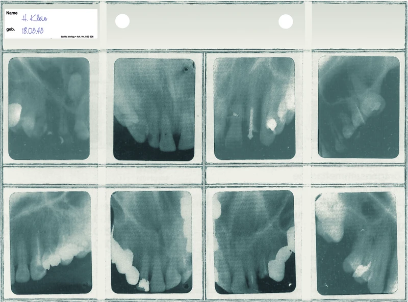 Röngtensichthüllen  Packung  100 Hüllen 40 x 50 mm, für 8 Aufnahmen und DIN A5