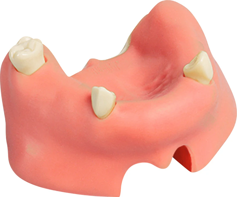 Implantologie-Übungsmodell  Stück  OK mit Sinusschleimhaut