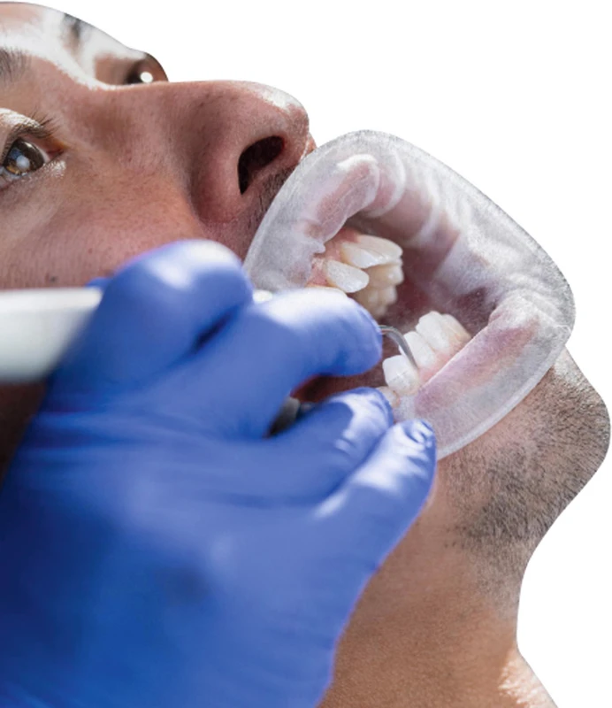 VivaDent® Aerosol Reduction Gel  Starter Kit  2 Vivadent Mixing Bottle, 100 x 2,16 ml Gel