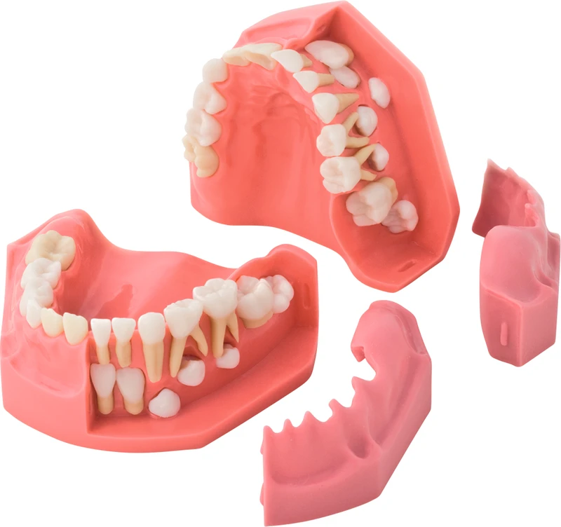 Wachstumsmodell 5\9 Jahre P1-600B  Stück