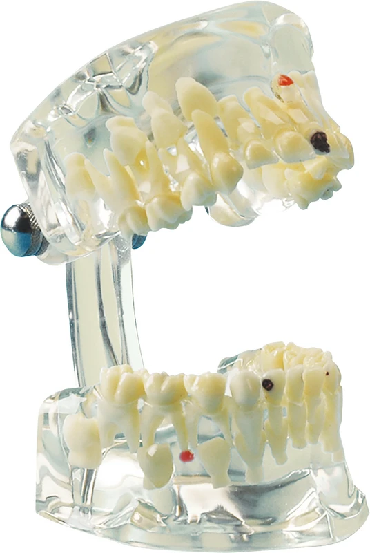Studienmodell Transparent Kind  Stück  UK und OK mit zehn Milchzähnen, transparent
