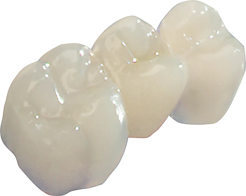 tempofit® regular 1:1  Standardpackung  50 ml Doppelkartusche A2, 10 Mischkanülen