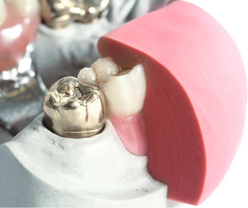 dentona 1:1 gum  Eimer  2 x 1,5 kg