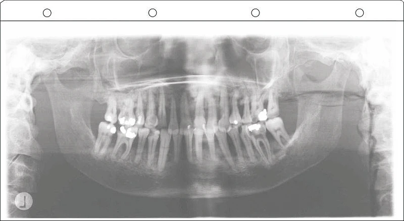 Panostar® Filmtaschen  Packung  100 Stück 15 x 30 cm