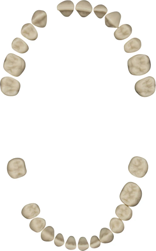 Zahnsatz für Parodontologiemodell A-PB   Packung  26 Stück