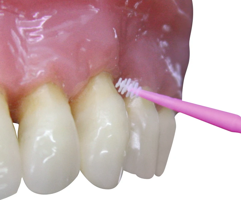 smartseal® cervi  Standardpackung  5 ml Flasche mit Tropfeinsatz, 50 Applikatoren pink, 24 Doppel-Einwegschalen