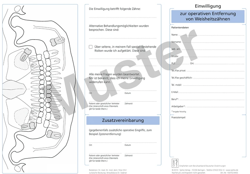 Einwilligungsbögen   Packung  50 Stück zur operativen Entfernung von Weisheitszähnen
