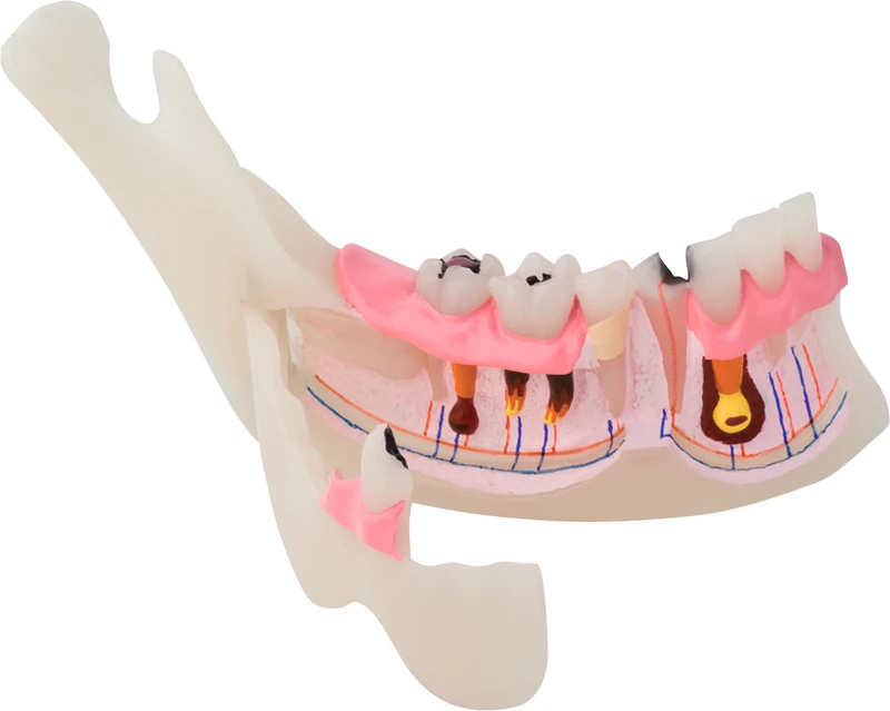 Pathologisches halbes UK Modell P13-TR10  Stück