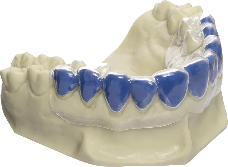 DRUFOLEN W  Packung  40 Stück Ø 120 mm, blau, Stärke 0,65 mm