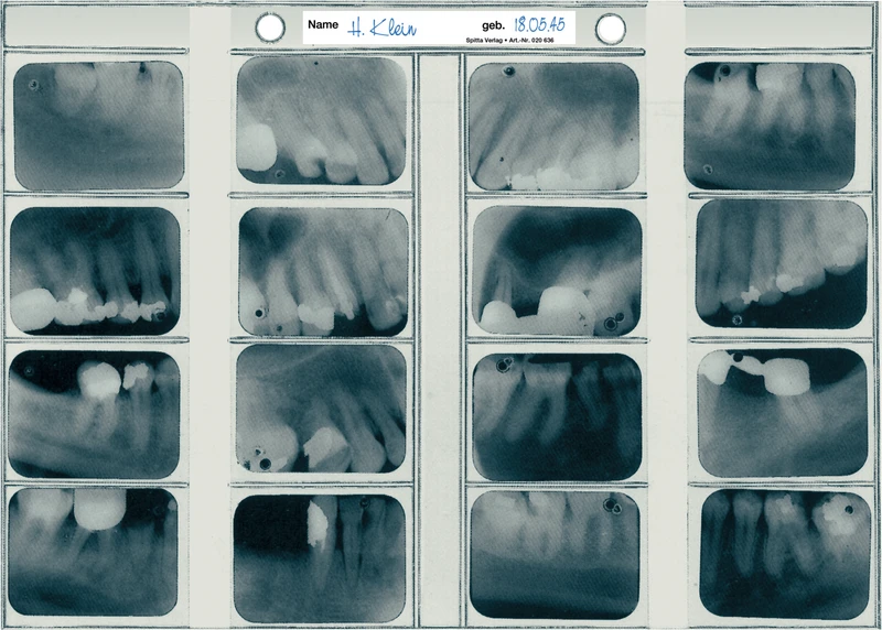 Röngtensichthüllen  Packung  100 Hüllen 30 x 40 mm, für 16 Aufnahmen und DIN A5
