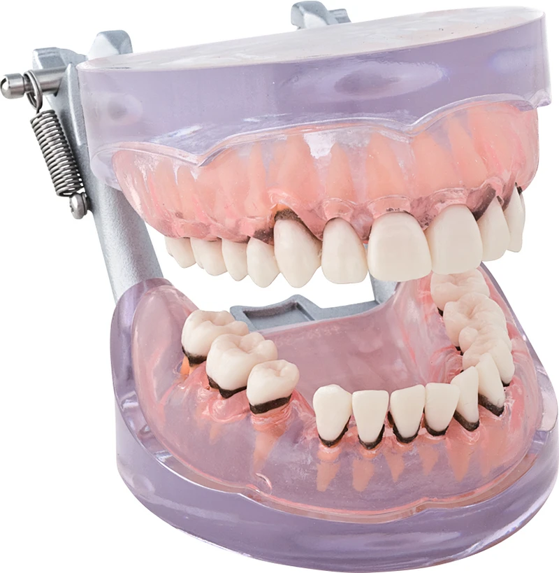 Parodontiemodell P15D-TRM205  Stück