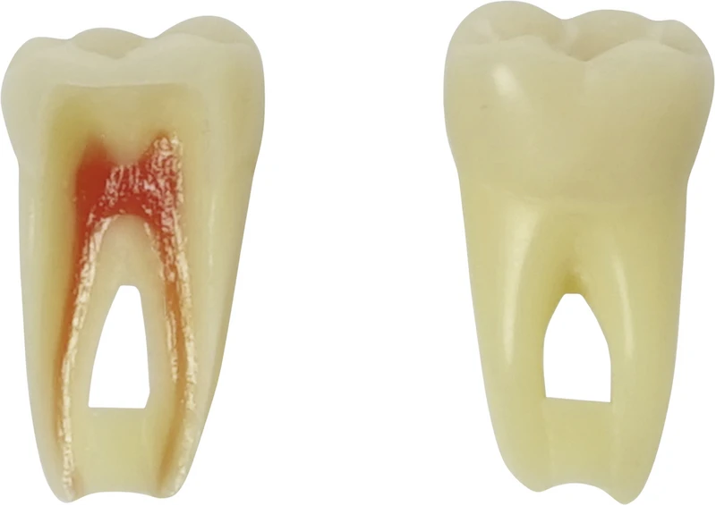 Modellzähne ANA-4 ZPURN  Stück  Nr. 36