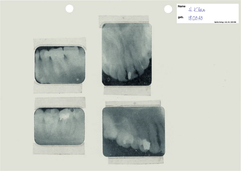 Röntgenfolie  Packung  100 Stück