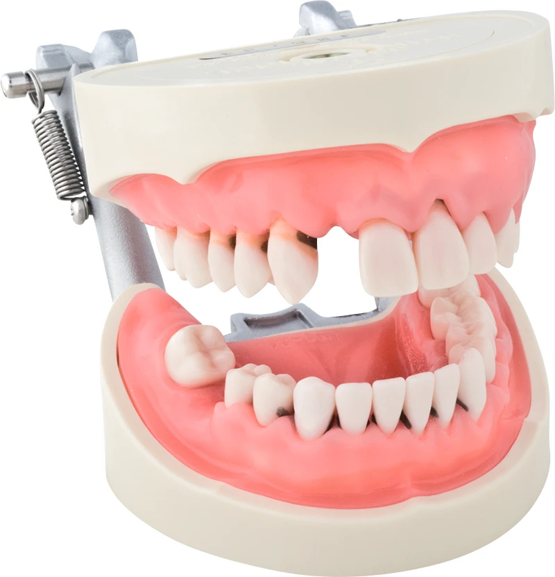 Parodontiemodell P15D-JME24  Stück