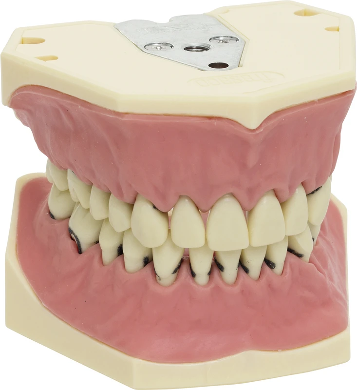 Arbeitsmodell A-PZ  Stück  OK\UK inklusive Zähne, 1 Zahnfleischauflage