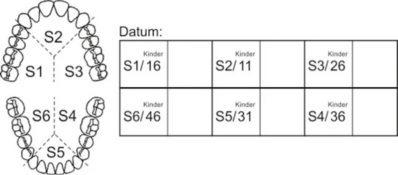 Stempel PSI TABELLE  Stück