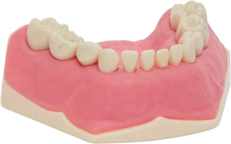 Kinderzahnmodell AK-6  Stück  UK inklusive 10 Zähne