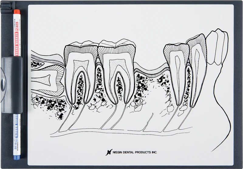 Demonstrationstafel Seitenzahnbereich P13-TR200  Stück