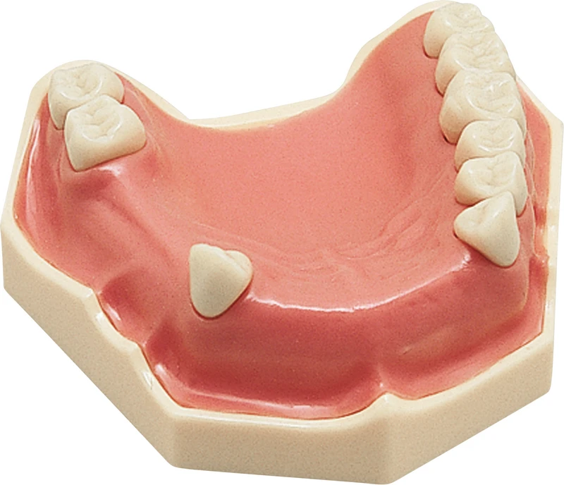 Arbeitsmodell AG-3  Stück  OK teilbezahnt (8-7-5-4-3-2-1 | 1-2-3-4-5-7-8)