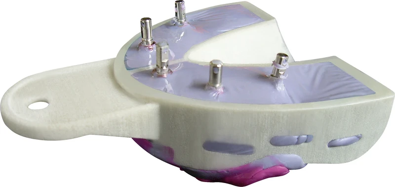 Miratray® Implant  Introkit  6 Löffel